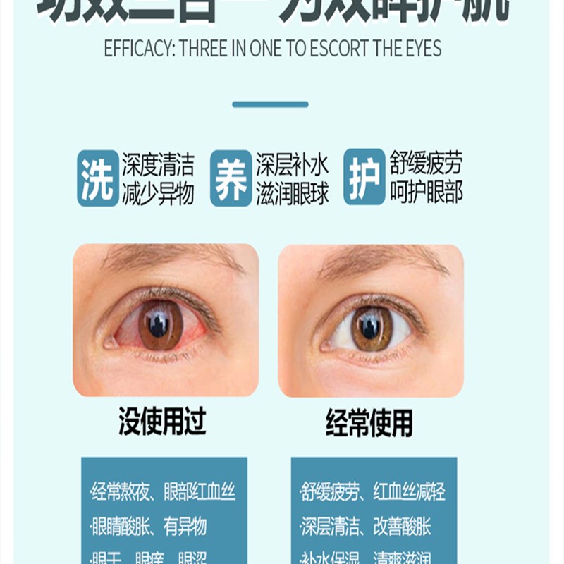 极速眼睛c红血丝修复去除眼水缓解眼睛干涩疲劳痒滴眼液去黄神器