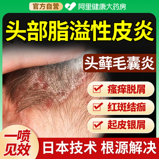 脂溢性皮炎头癣头皮屑真菌感染头部毛囊炎头发头痒有疙瘩痤疮喷剂