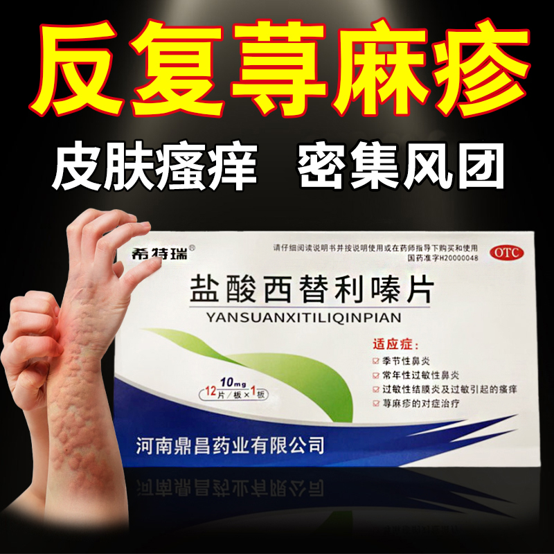 盐酸西替利嗪片治疗寻荨麻疹过敏止痒专用药皮肤瘙痒过敏药鼻炎