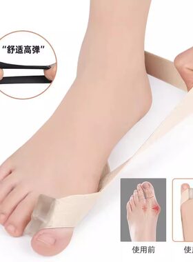夏季重叠可穿鞋男女大脚骨矫正器