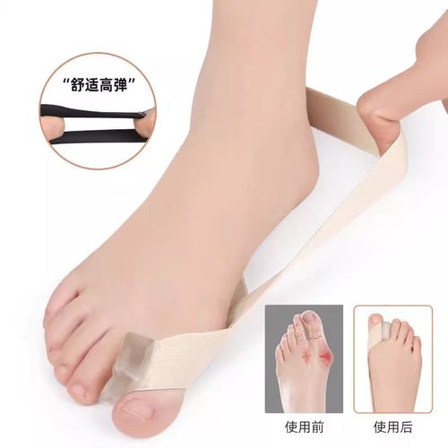 夏季重叠可穿鞋男女大脚骨矫正器
