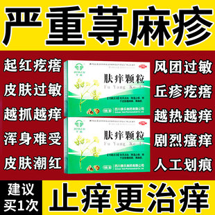 肤痒颗粒正品治疗寻荨麻疹过敏止痒断特痒根用效药皮肤瘙痒止痒