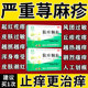 肤痒颗粒正品 治疗寻荨麻疹过敏止痒断特痒根用效药皮肤瘙痒止痒