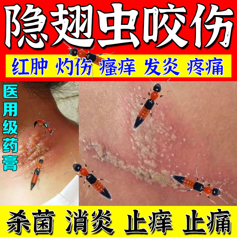 【星海】炉甘石洗剂5%5%15%*100ml/瓶