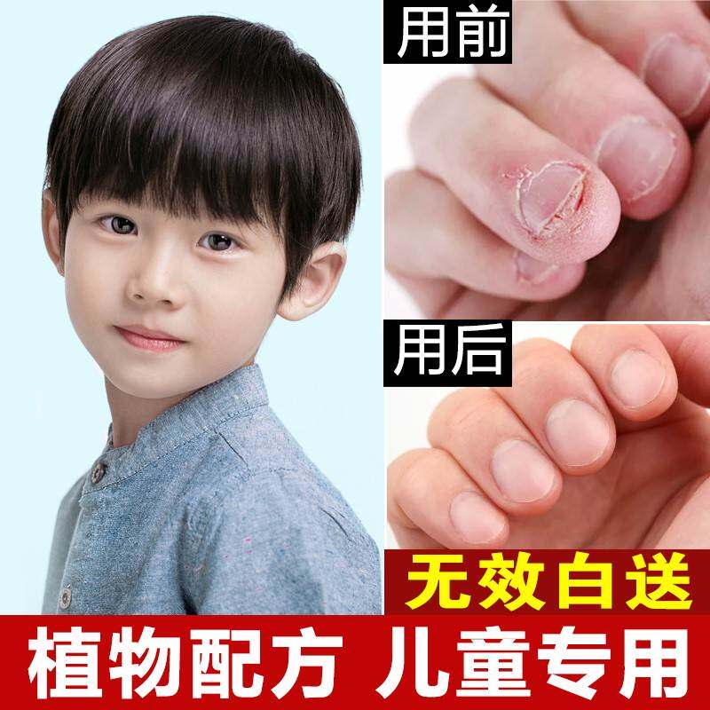 极速Bitter nail water teenagers eat hands Coptis chWinensis