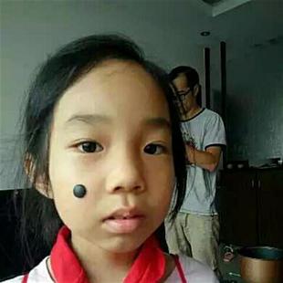 极速搞笑好e玩假痣假痦子媒婆痣矽胶痣舞蹈表演出演员道具