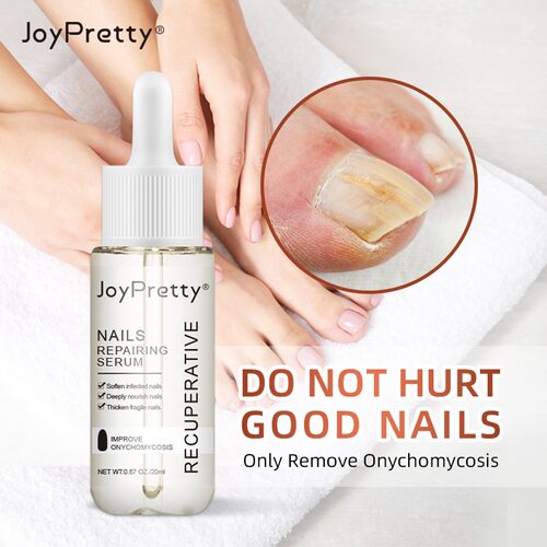 极速Fungal Nail Treatment Serum FoEot Repair Essence Care Wh