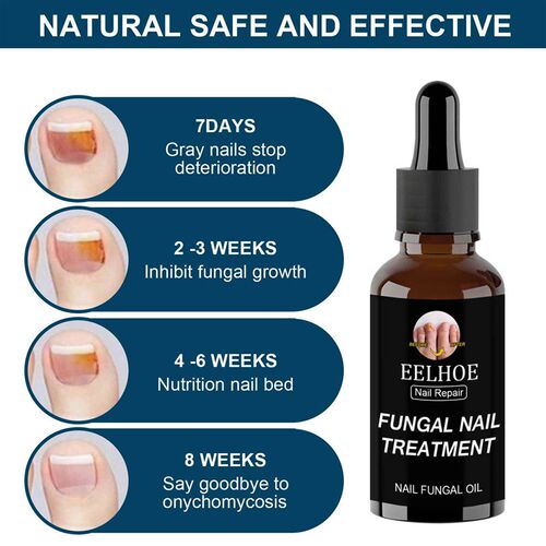 极速30ml Fungal Nail Repair Essence Feet CarOeTreatment Foot