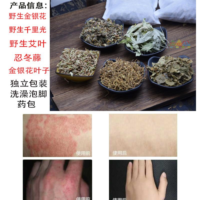 金银花艾泡藤婴儿忍冬藤泡澡野生干澡金银花艾INN叶宝宝洗澡草去