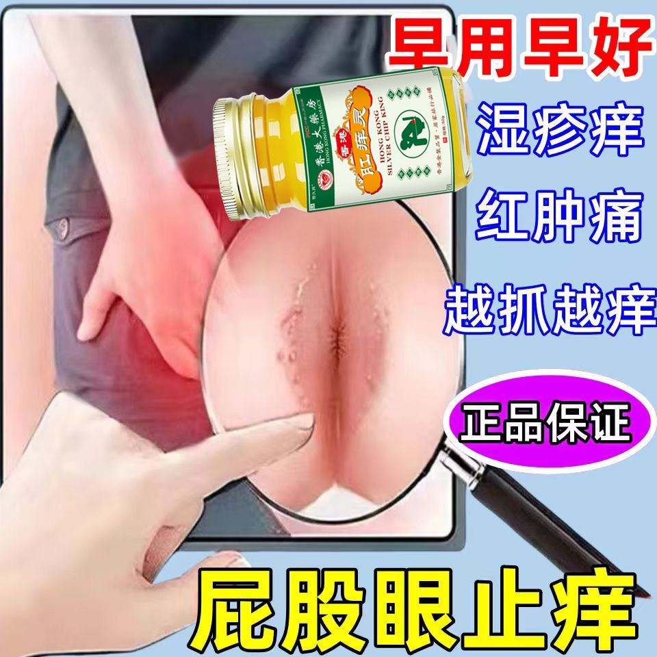 肛痒灵肛门瘙痒顽固膏药屁股眼止痒抑菌肛周专用湿瘙痒疹根去潮湿
