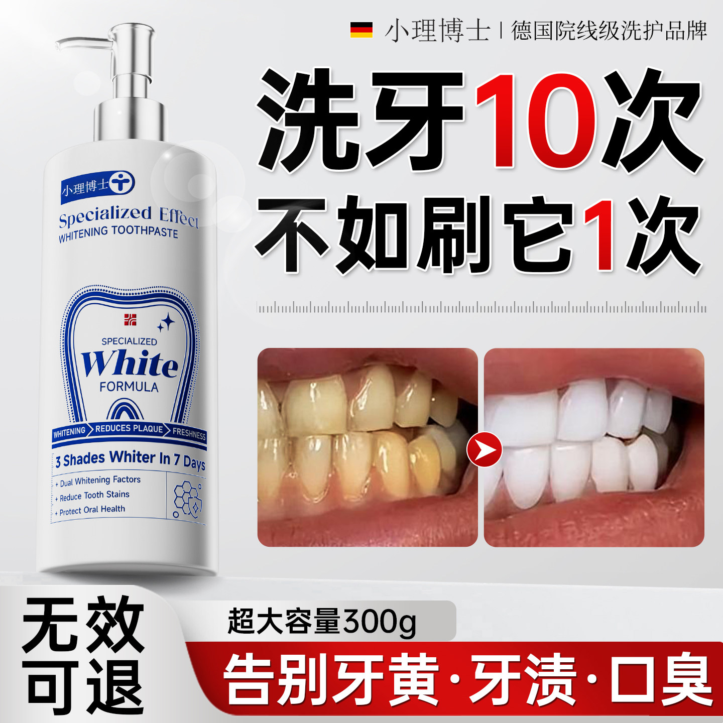 德国进口原料美白牙膏含氟去黄口臭牙渍结石烟渍速效洗白清新口气