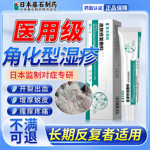 手足角化型湿疹脚增厚脱皮干裂真菌感染手指干燥起皮手指角质型HA