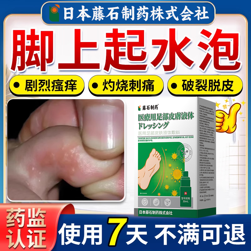 【拆用可退】脚上起水泡专用喷剂