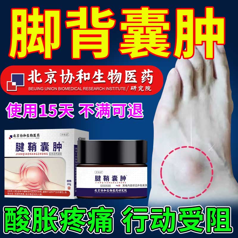 脚背腱鞘囊肿鼓包膏可搭膏贴治疗脚面鼓包凸起肿痛舒筋特效止痛zr
