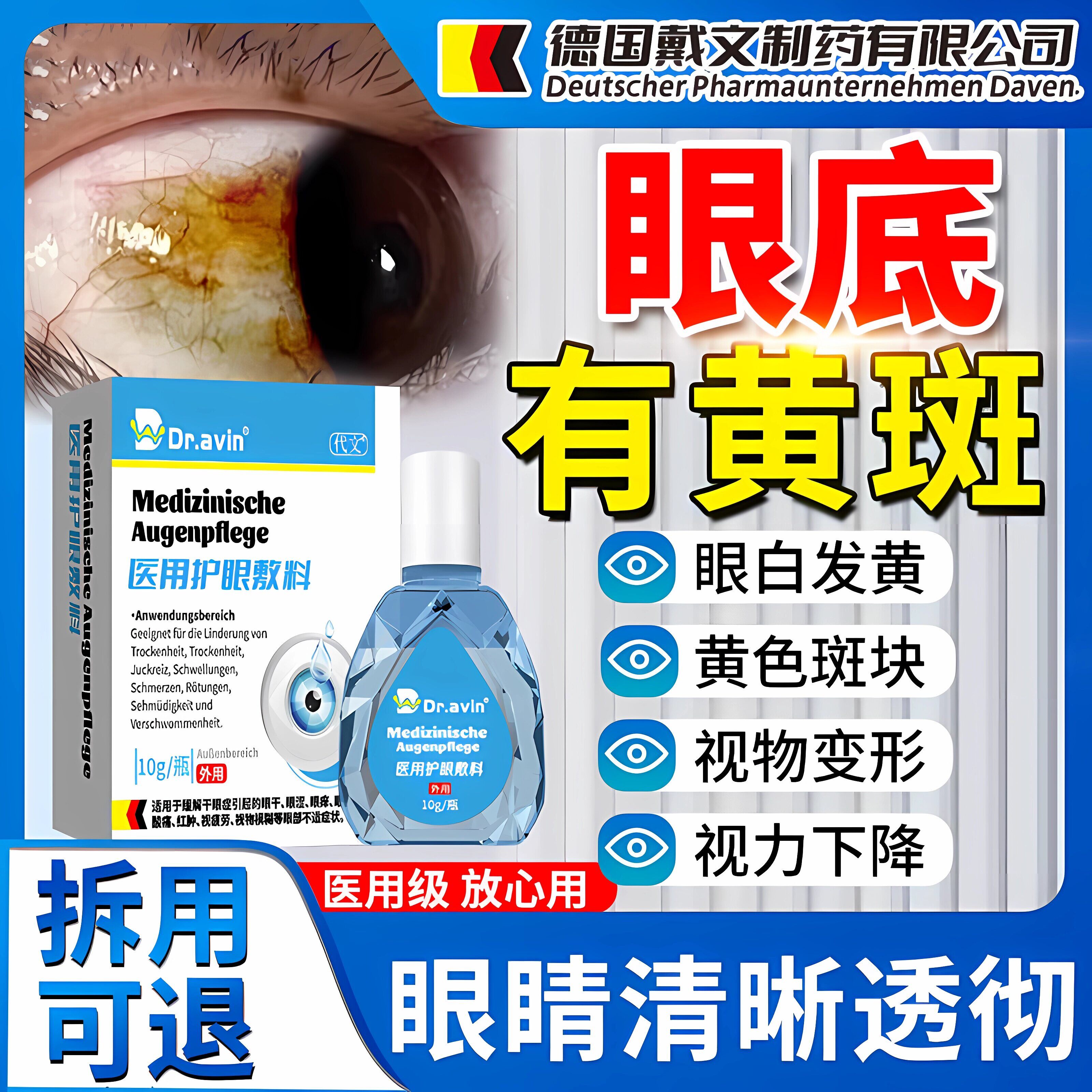 眼底黄斑病变水肿可搭眼药水治眼底出血疗眼睛模糊看不清去黄ZR