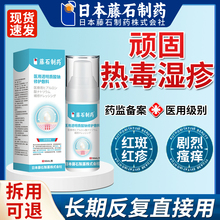 热毒湿疹专用除湿止痒膏喷剂去治疗皮肤瘙痒根水泡除红斑疹感染JV