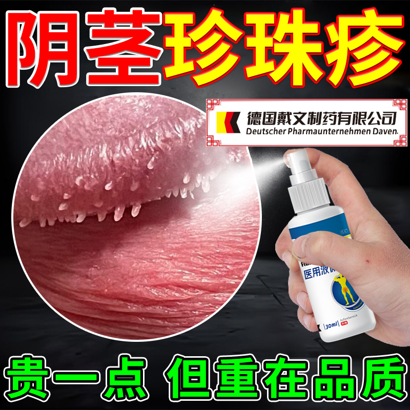男性珍珠丘疹专用龟头炎阴茎小疙瘩去除阴茎冠状沟珍珠粒疹喷剂AZ