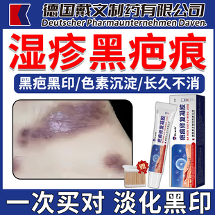 湿疹疤痕黑色素沉淀专用去湿疹疤痕黑印蚊虫叮咬疤痕淡化修复膏AZ