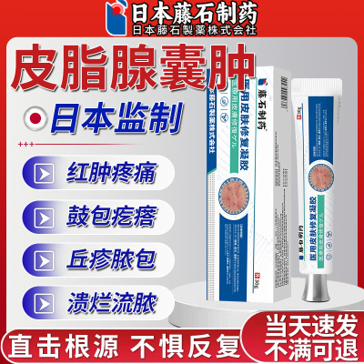 【拆用可退】皮脂腺囊肿专用膏