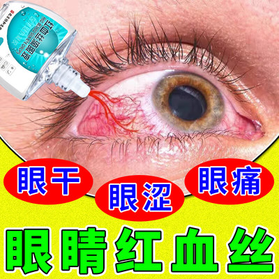 【医用级】去红血丝专用滴眼液