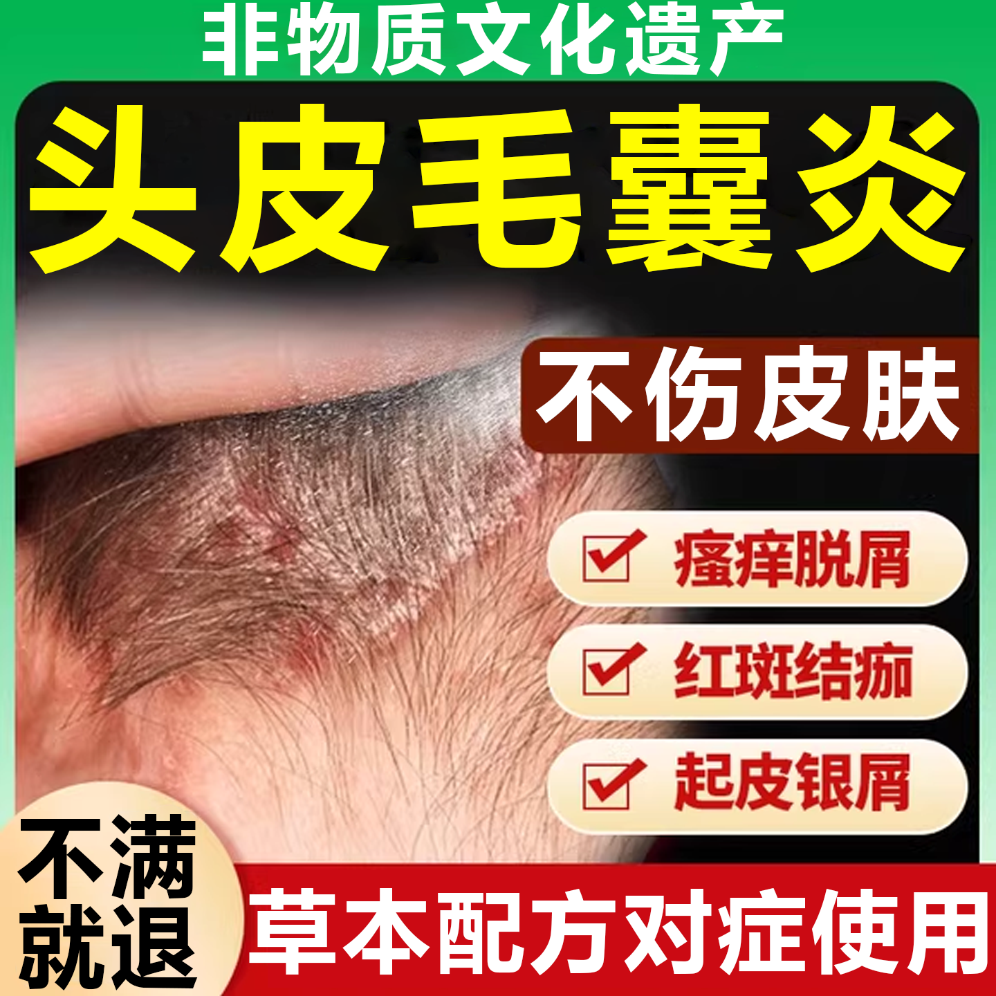 头皮毛囊炎外阴瘙痒有红小疙瘩脓包药身上头上后背长痘痘专用膏