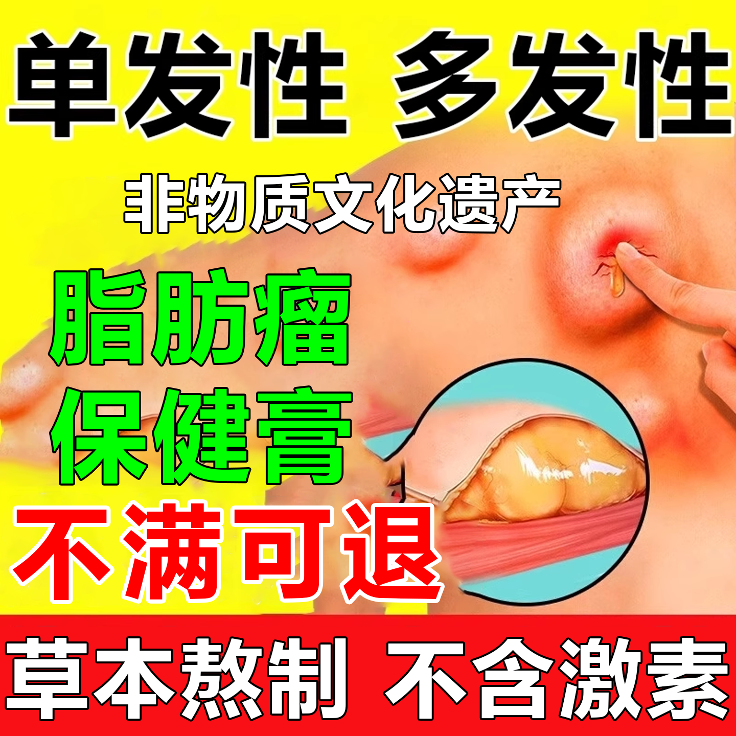 马寺源百年非物质文化遗产祛除脂肪瘤配方