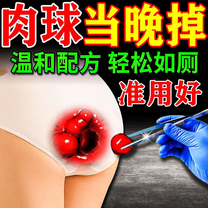 日本痔痣疮膏药排行榜第一名消肉球女性内外痔根中断去神正品除器