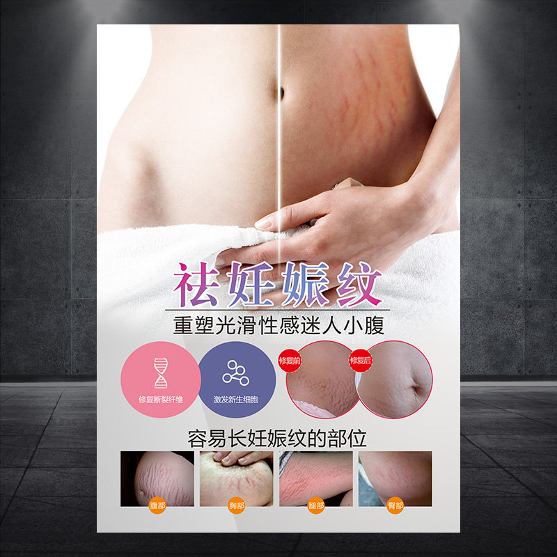 产后修复中心祛除妊娠纹海报宣传画广告展板KT板挂图墙纸贴画1244