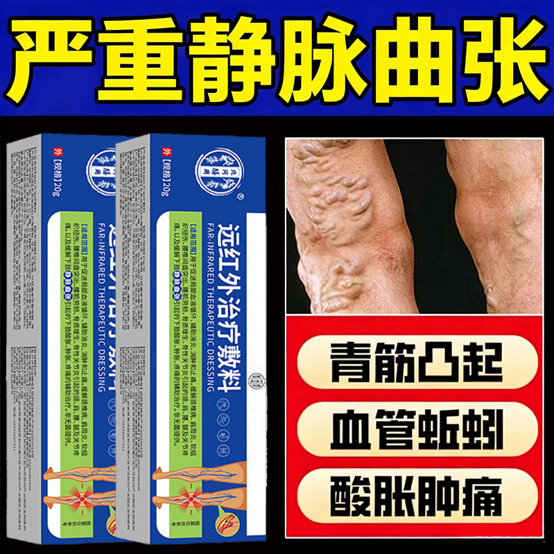 北京同仁堂静脉曲张专用膏青筋凸起红血丝血管堵塞肿胀烂腿热敷膏