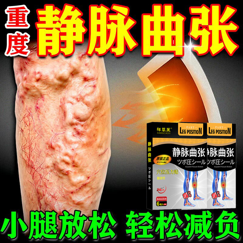 祥草医静脉曲张远红外穴位贴