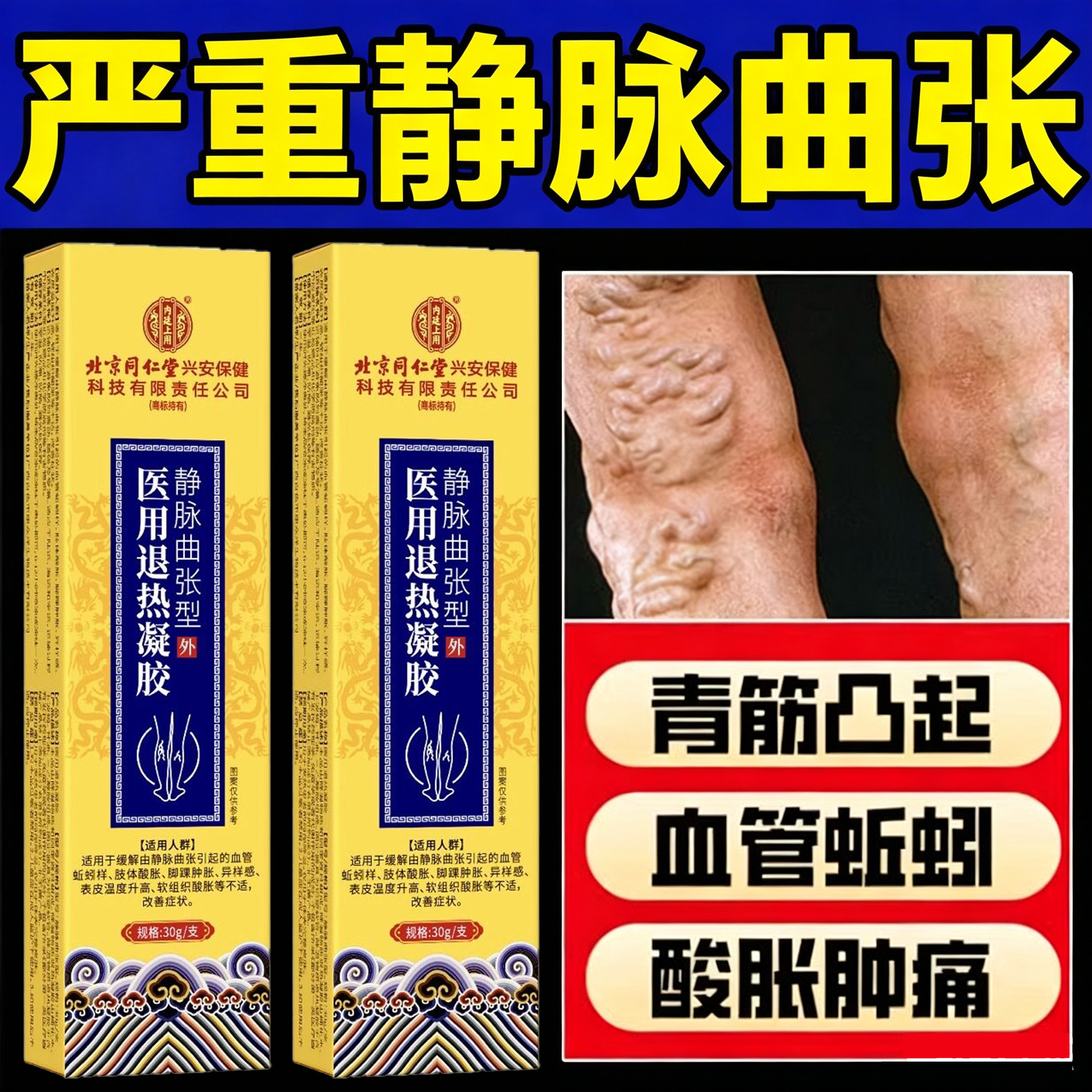 北京同仁堂静脉曲张专用膏青筋凸起红血丝血管堵塞肿胀烂腿热敷膏