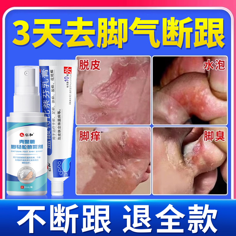 【仁和】盐酸特比萘芬乳膏1%*10g*1支/盒