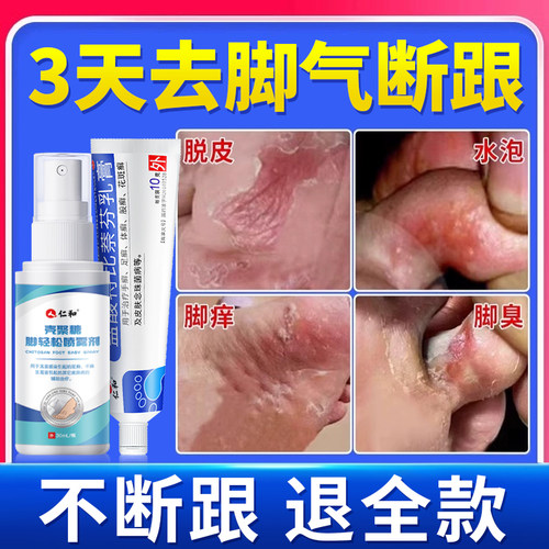 【仁和】盐酸特比萘芬乳膏1%*10g*1支/盒