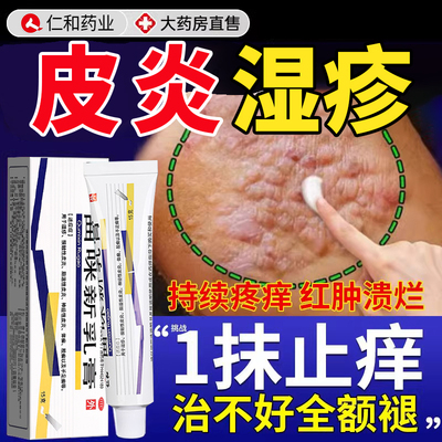 治疗湿疹神经性皮炎专用药膏顽固皮肤瘙痒无激素去除外用止痒膏xl
