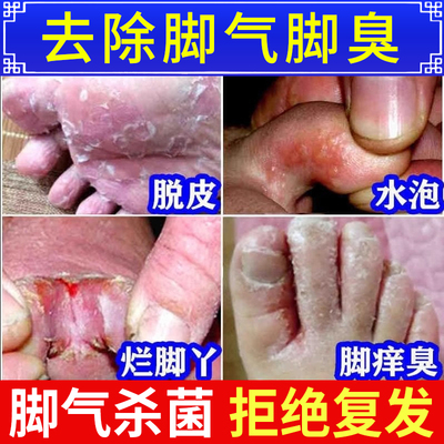 【太平】酮康唑乳膏15g*1支/盒