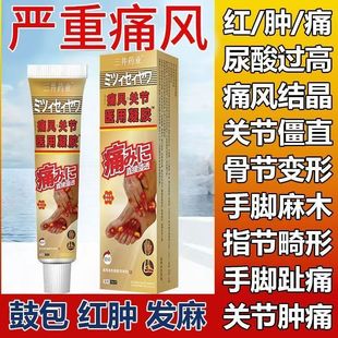三井制药痛风止痛溶石骨痛贴膏尿酸红肿关节疼缓解正品官方旗舰店