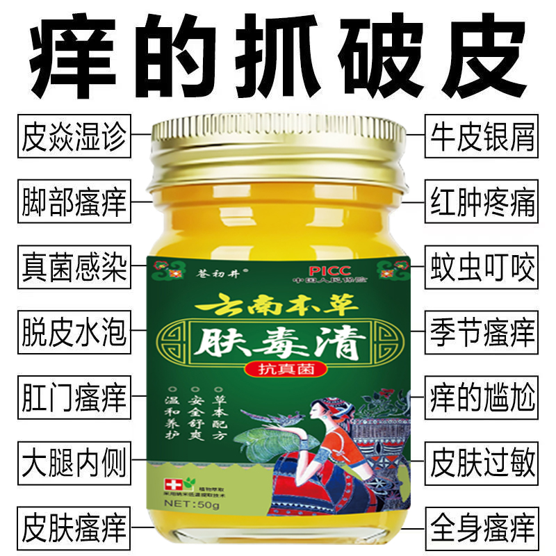 肤毒清云南本草特效皮肤瘙痒外用全身上痒手脚干痒真菌止痒膏杀菌