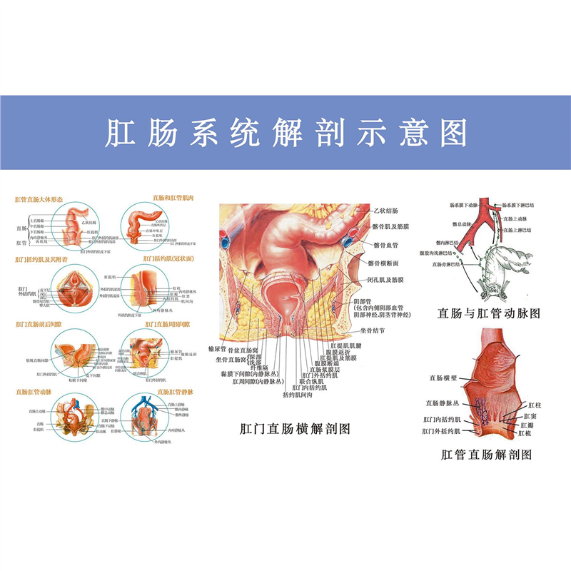 肛肠常见痔疮疾病图例墙贴肛肠科解剖图医院挂图广告宣传海报