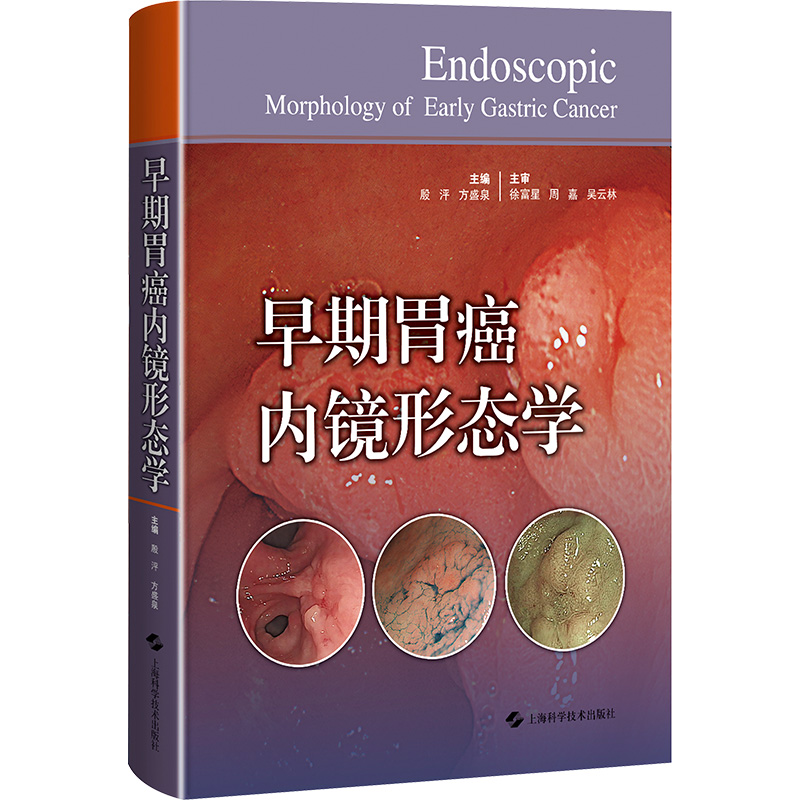早期胃癌内镜形态学殷泙 方盛泉 主编上海科学技术出版社9787547861967