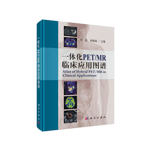 一体化PET/MR临床应用图谱李彪，林晓珠科学出版社9787030654304