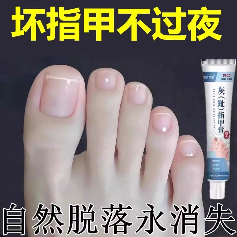 【专攻灰甲】指甲专用草本植物膏严重指甲增厚亮甲草本膏,洗护清洁剂/卫生巾/纸/香薰,护手霜,淘宝优惠券,粉丝福利购,淘宝优惠卷