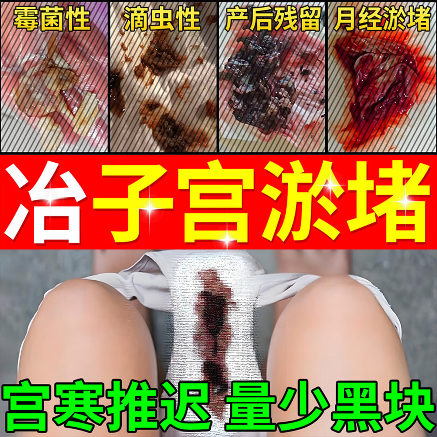 子宫淤堵贴宫寒淤堵月经量少调理气血块不足发黑淋漓不尽大姨妈