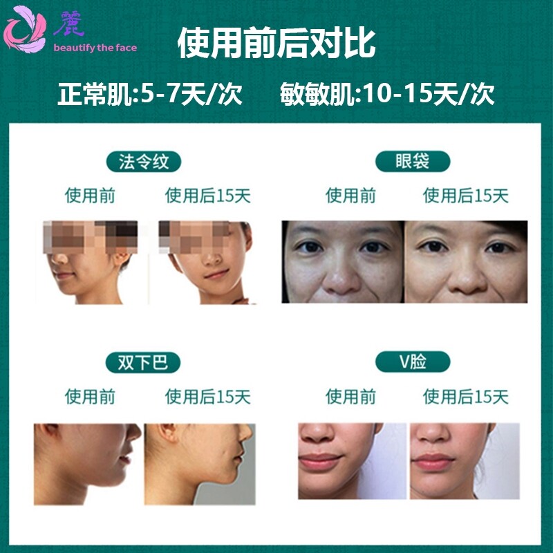 面部精雕嫩肤仪深源热超声波家用美容仪个人护理提拉紧致导入仪