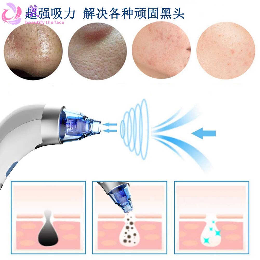新款吸黑头仪电动吸毛孔清洁器小气泡美容神器吸出粉刺去黑头仪器