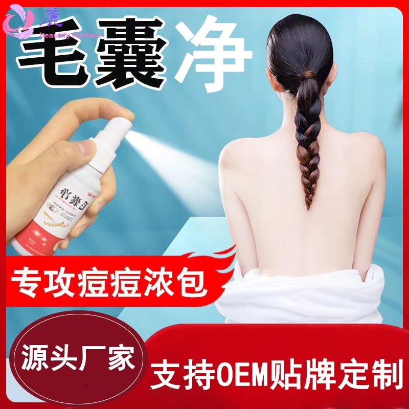 邹润安毛囊净抑菌液头皮头痒头油毛囊止痒清洁毛囊草本喷剂