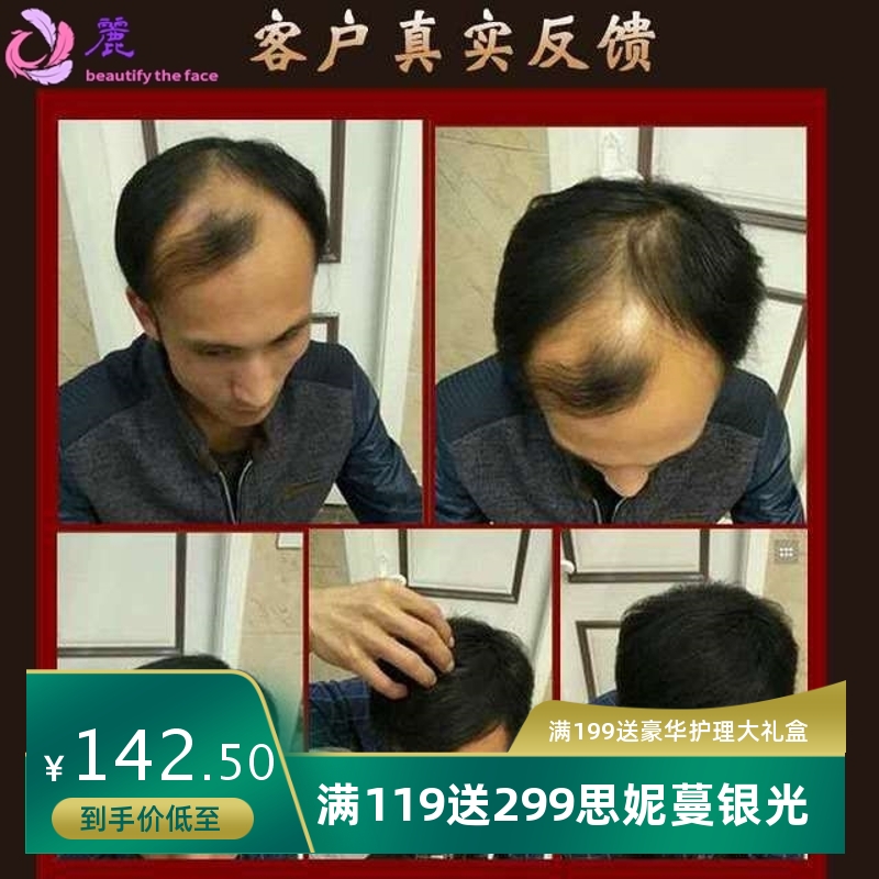 防脱育发液增发密发防脱发坚韧发根长发际线头皮护理固发养发液