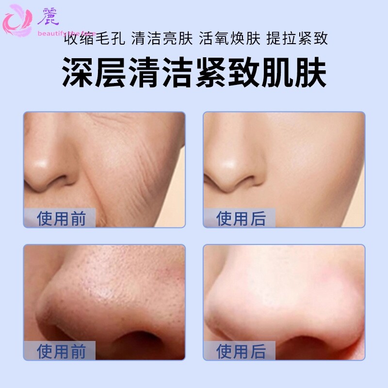 LISA丽莎黑珍珠皮肤管理仪器面部清洁提拉紧致美容院大气泡美容仪