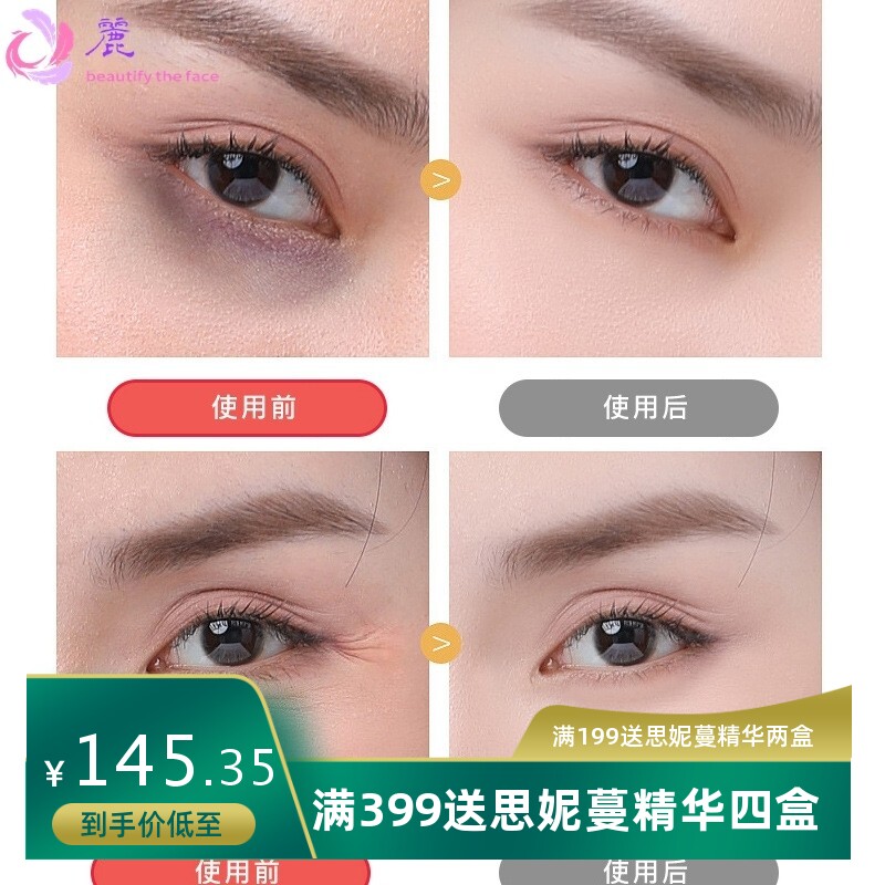 高端眼部雾化仪热敷眼部熏蒸仪蒸汽按摩美目仪美容院青少年护眼仪