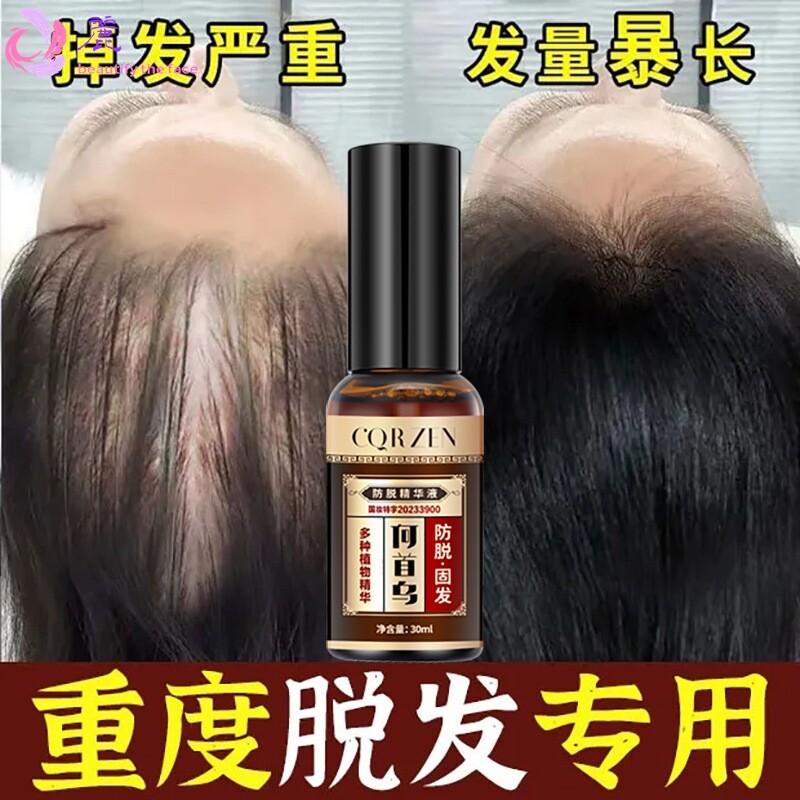 CQRZEN防脱精华液秃顶怪光头佬救星出浓密发量顽固发质不断不掉