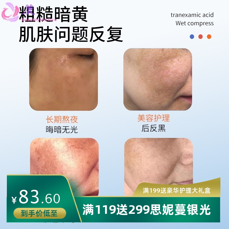 iOEO氨甲环酸湿敷液100ml暗沉黑色素提亮传明酸精华液湿敷水